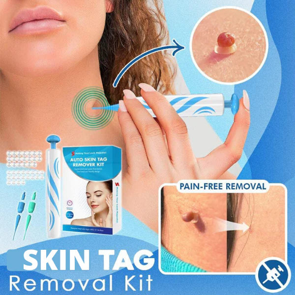 Skin Tag Removal Kit