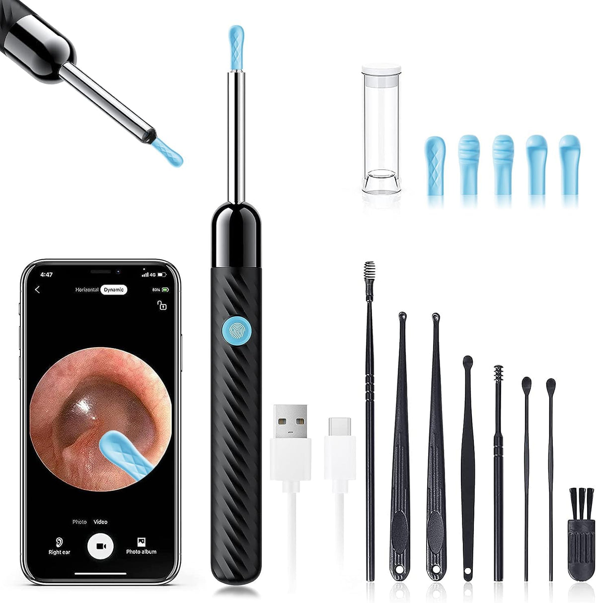 Ear Wax Removal - Makfoul