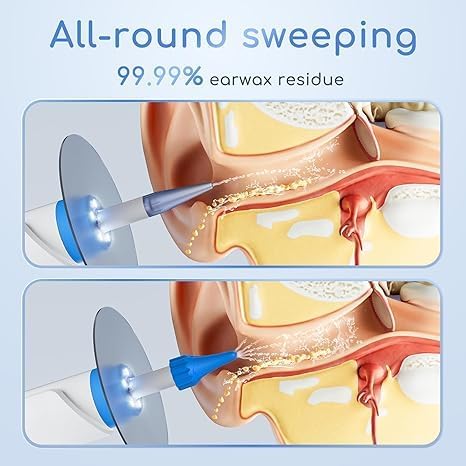 Electric Ear Irrigation Kit - Makfoul