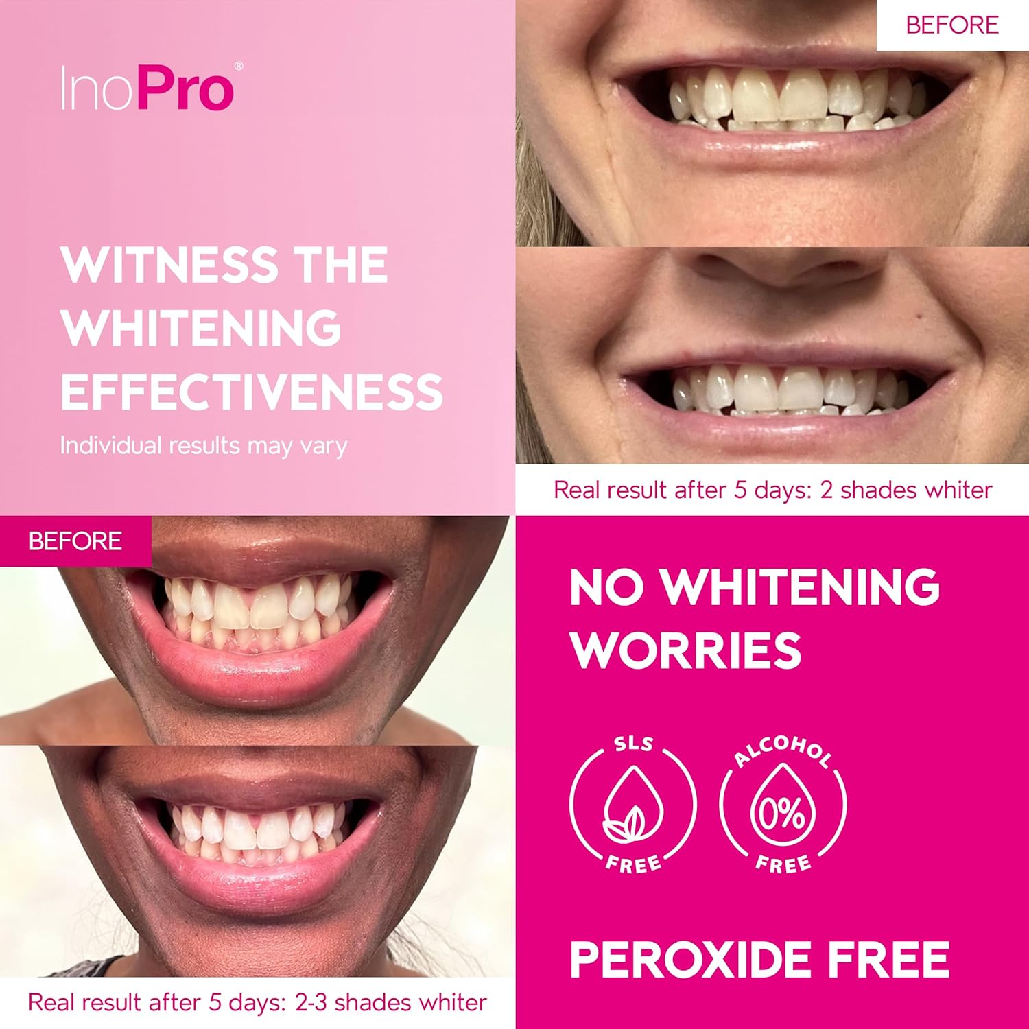 INOPRO ® Teeth Whitening Strips - Makfoul