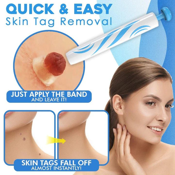Skin Tag Removal Kit - Makfoul